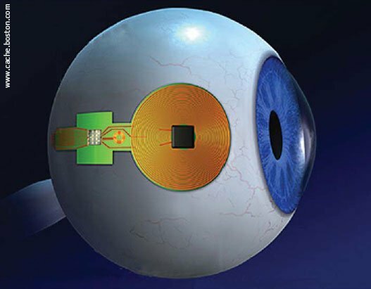 Биоэлектронный гибрид глаза
