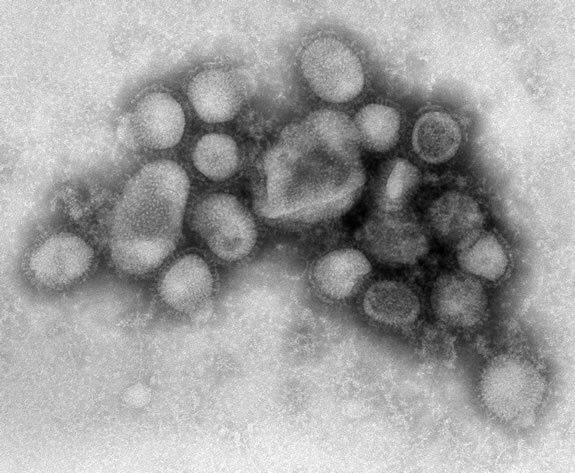 В России подтверждено 12 случаев заражения вирусом H1N1