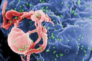 Лекарство от ВИЧ-инфекции найдено!