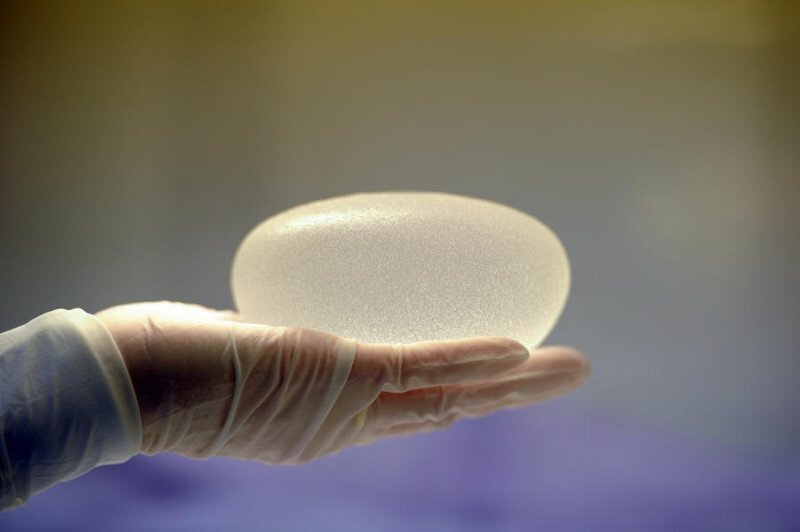 Новые имплантаты с микрочипами помогут сохранить здоровье женщин