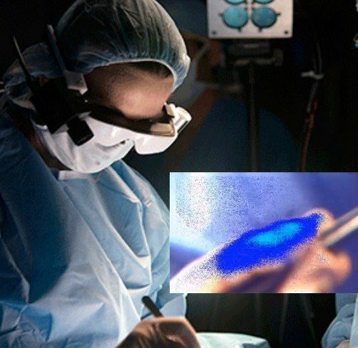 Ученые придумали уникальные очки, через которые видны раковые клетки