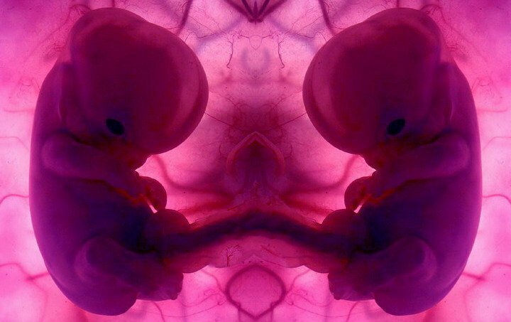Американские ученые разработали методику, позволяющую получать эмбрионы от трех родителей