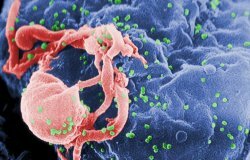 Лекарство от ВИЧ-инфекции найдено!