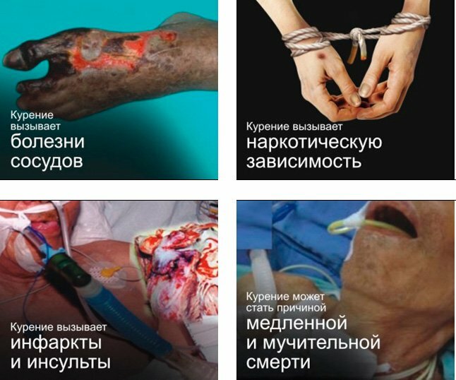 Теперь уже и в России мерзкие картинки "украсят" сигаретные пачки