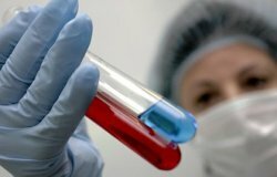 В России завершаются испытания новой вакцины против СПИДа